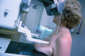 Mammographie examen